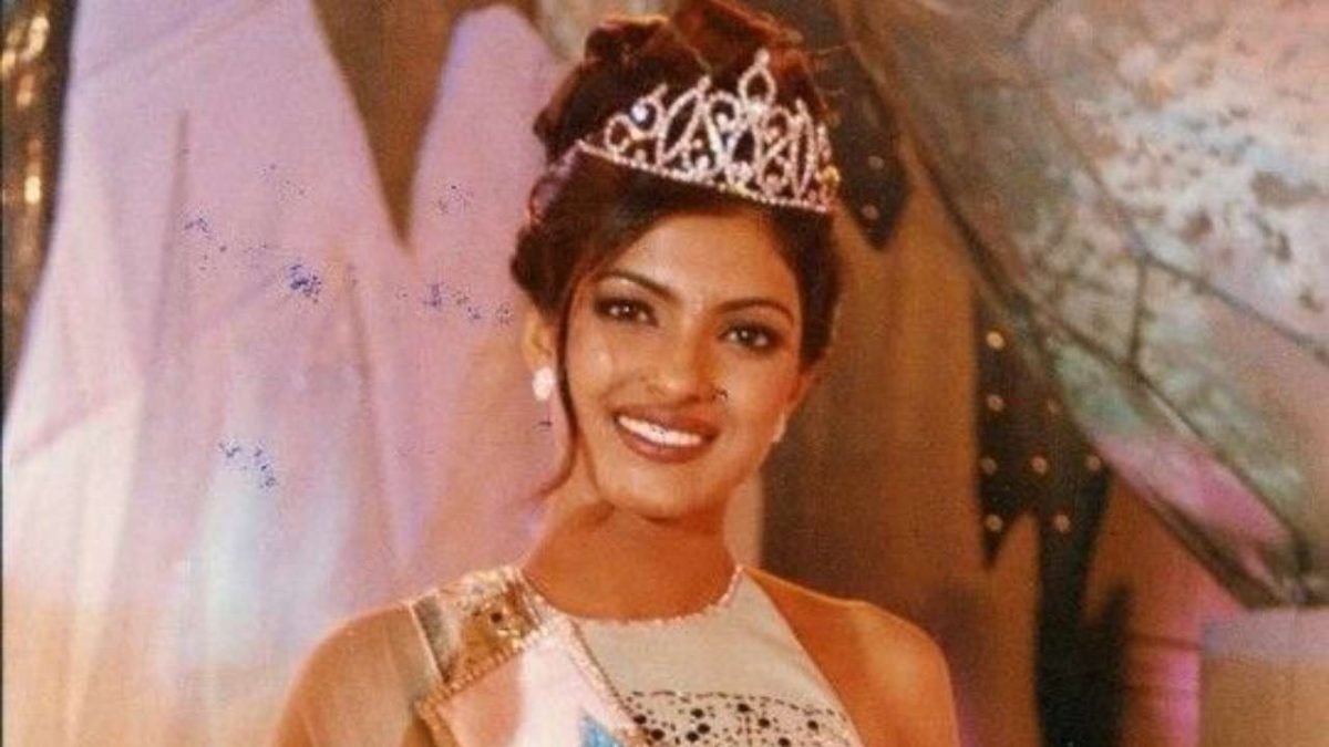 Did You Know That Priyanka Chopra Burnt Herself Before Being Crowned 