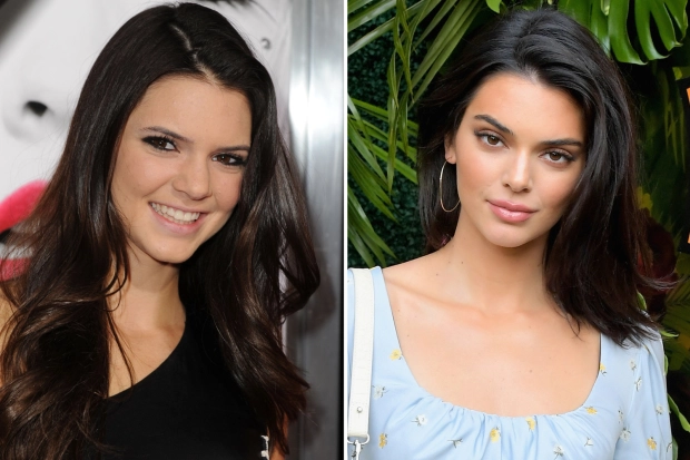 Did Kendall Jenner go under the knife for a secret plastic surgery ...