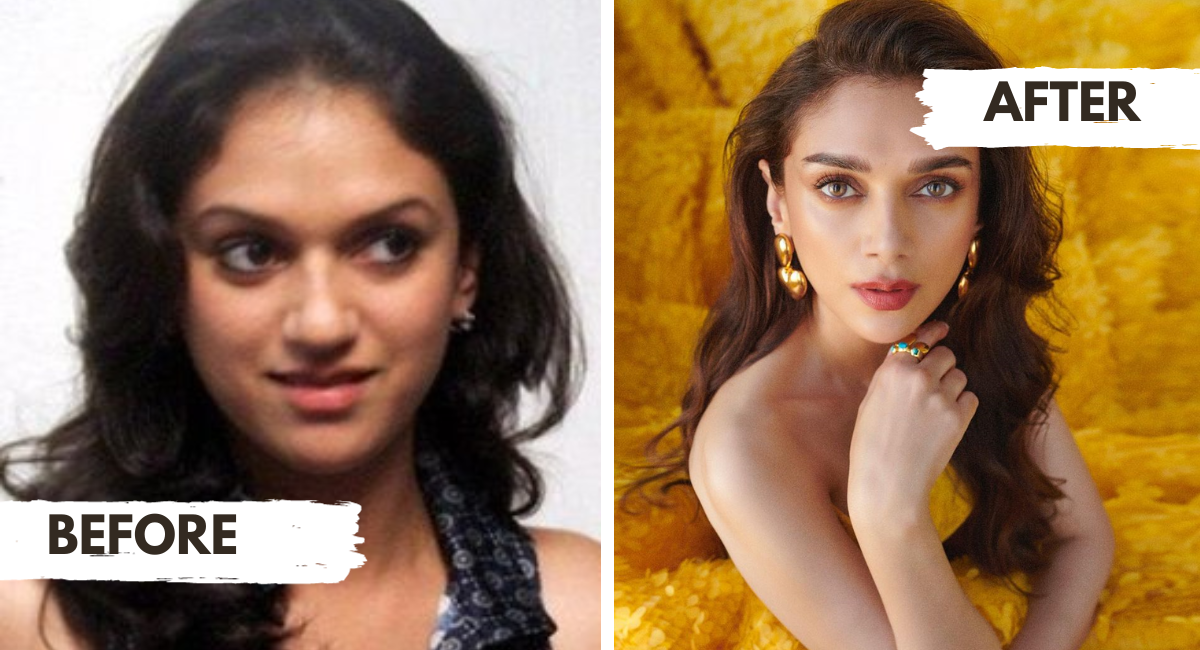 Beauty evolution or plastic surgery? Aditi Rao Hydri's before and after pics cause havoc online
