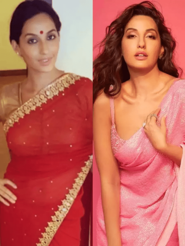 Nora Fatehi looks unrecognisable before and after surgery WATCH
