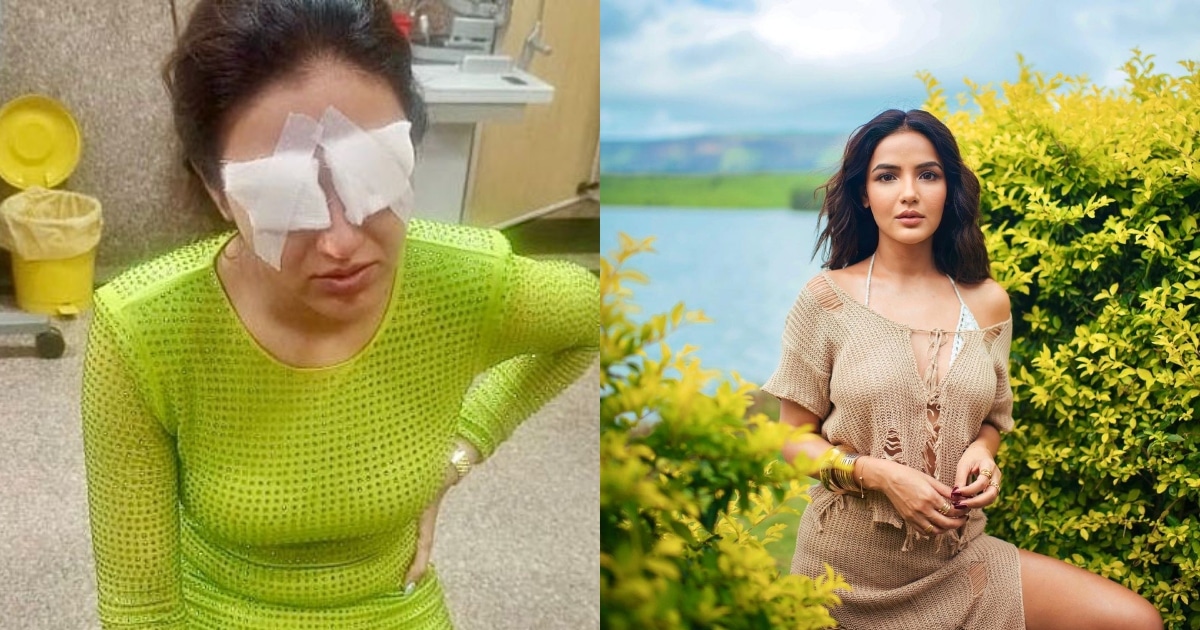 Jasmin Bhasin suffers corneal damage due to lens mishap