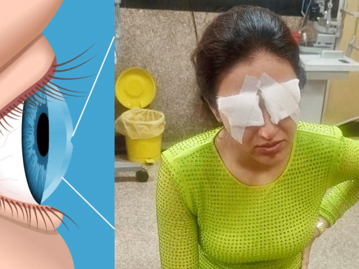 Jasmin Bhasin Corneal damage