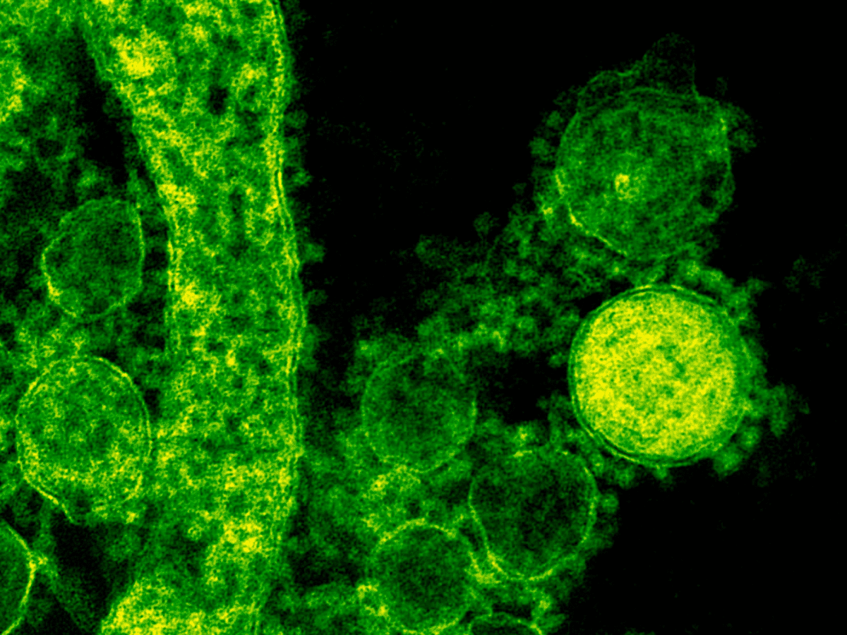 Norovirus