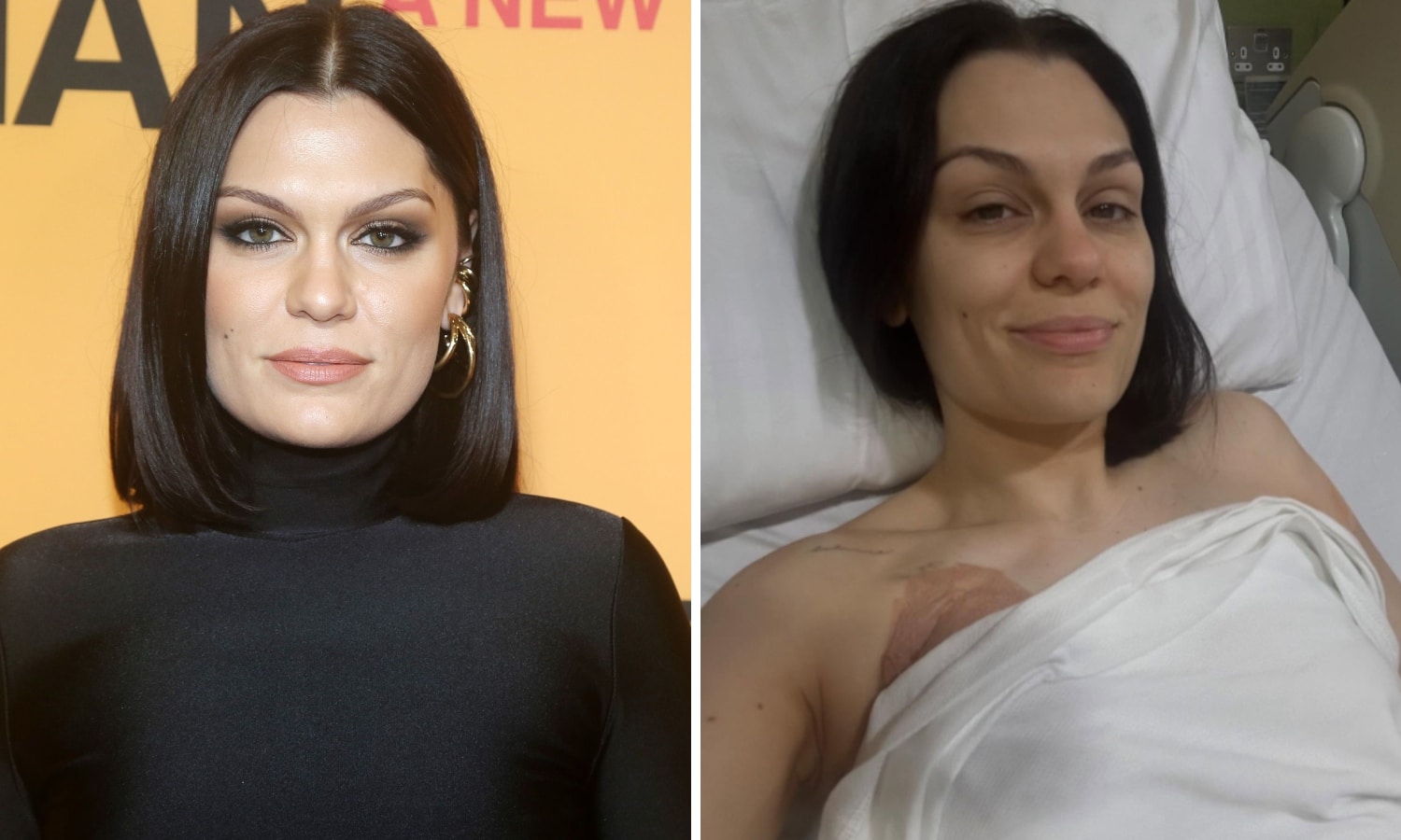 Jessie J shares touching video after breast cancer surgery