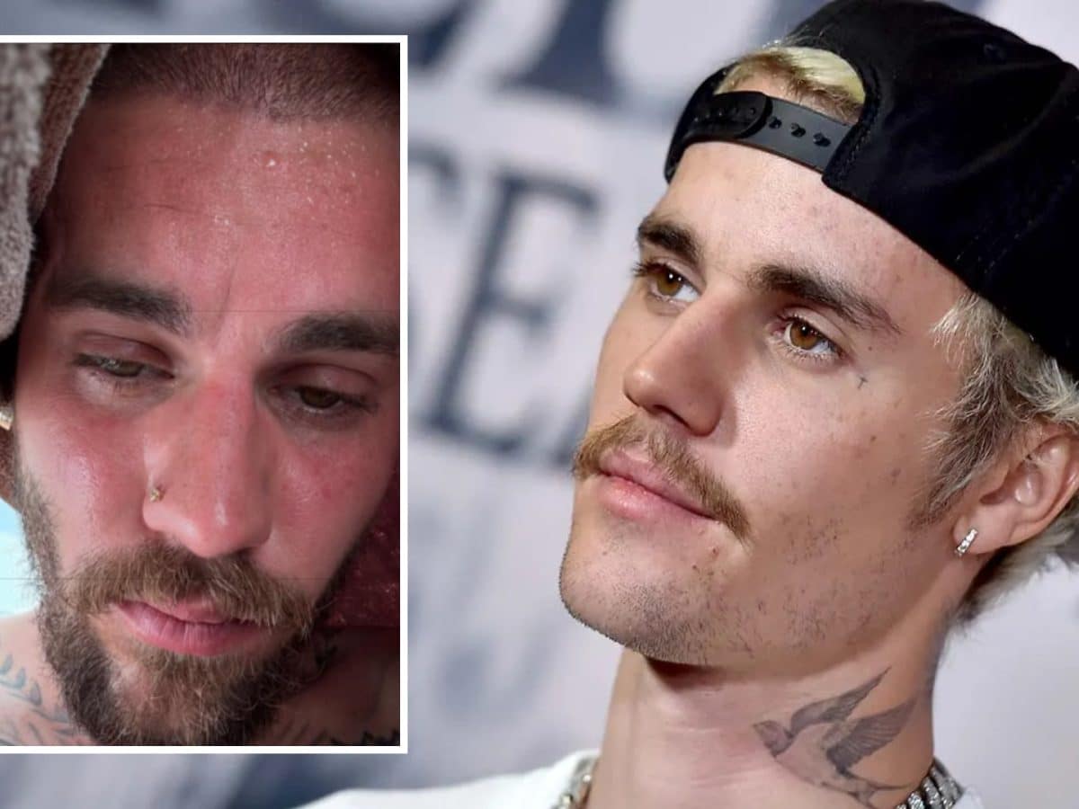 Justin Bieber’s sweaty detox selfies