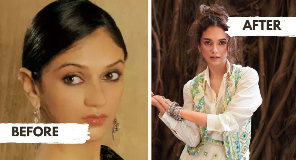 Beauty evolution or plastic surgery? Aditi Rao Hydari